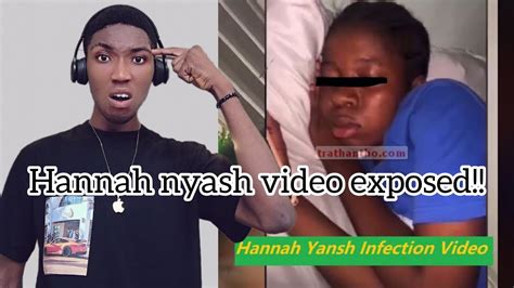 hannah yansh|Hannah Yanshs Infection Video Trending On TikTok,。